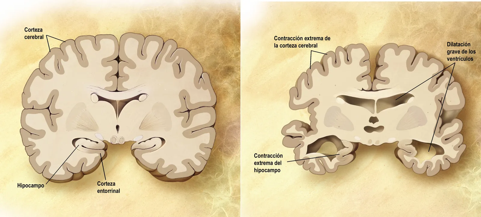 Coín impulsa programa de apoyo al Alzheimer